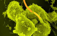 新的基于纳米颗粒的疫苗可预防炭疽和瘟疫