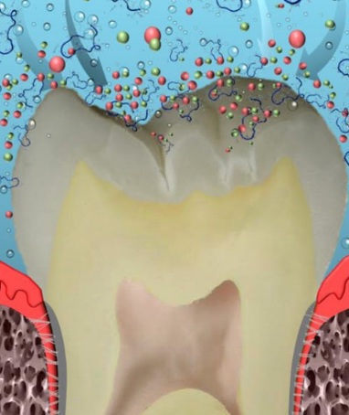 新的生物牙科产品重建牙齿珐琅质治疗蛀牙