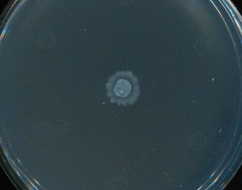 危险细菌沟通避免使用抗生素