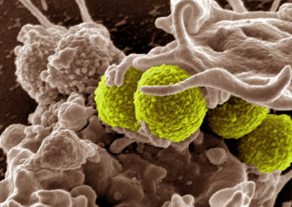 化学家合成了两种简化形式的杀死超级细菌的抗菌素Teixobactin