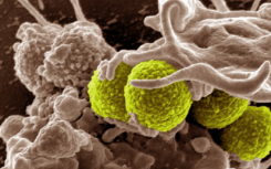 化学家合成了两种简化形式的杀死超级细菌的抗菌素Teixobactin