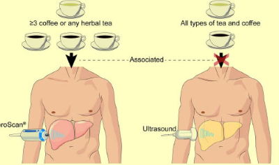 食用咖啡 凉茶可预防肝纤维化