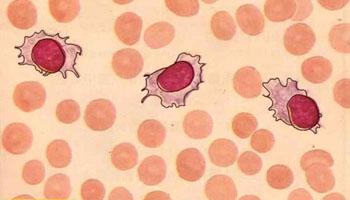 白血病B型细胞可通过表观遗传学改变转化为巨噬细胞
