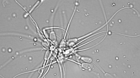 生物学家根据新陈代谢检查精子质量