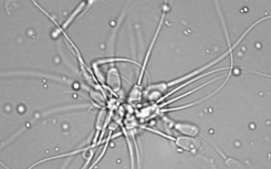 生物学家根据新陈代谢检查精子质量