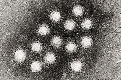 与浆果相关的甲型肝炎暴发蔓延至另一个州