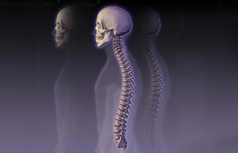 下脊柱融合后功能的变化反映了患者的特征