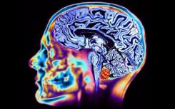 研究表明，夹竹桃苷可能是治疗HTLV-1病毒的有效新方法