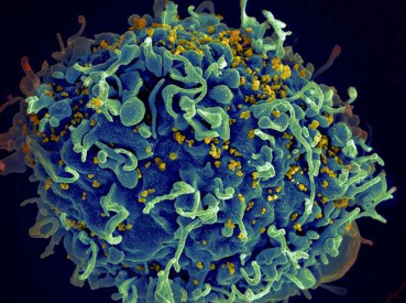 细菌释放的囊泡可减少HIV在人体组织中的传播