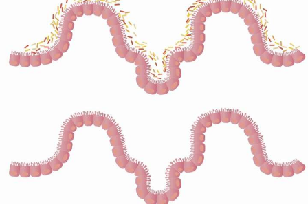 研究人员开发出改变肠道菌群 为炎症性疾病接种疫苗的方法