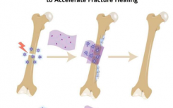 骨绷带吸收修复性生化物质以加速修复