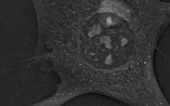新颖的3-D显微镜技术揭示了活细胞中的新现象
