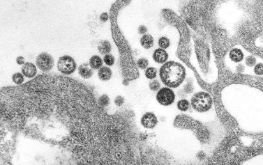 研究小组运用埃博拉病毒基因测序方法阐明了拉沙热的传播