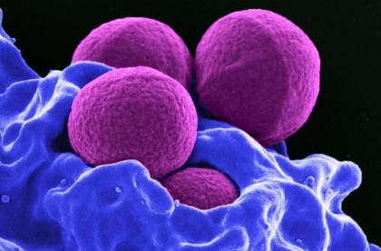 研究人员发现影响葡萄球菌细菌的因素