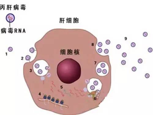 城市急诊室发现丙型肝炎感染率很高