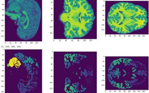 MRI可以进一步据测青少年大脑发育
