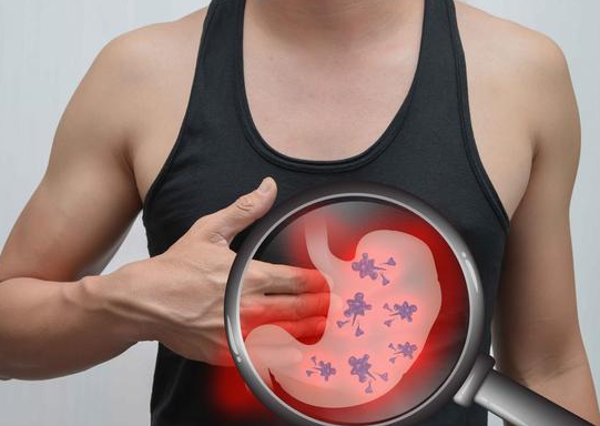 科普胃癌现状是发病率高及怎样预防胃癌