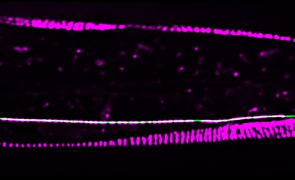 控制分子胶可保护脑细胞之间的连接