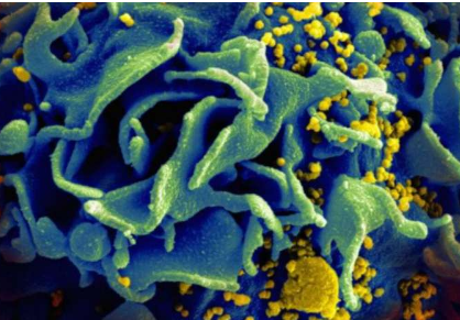 研究发现先天蛋白通过靶向脂质筏来限制HIV复制