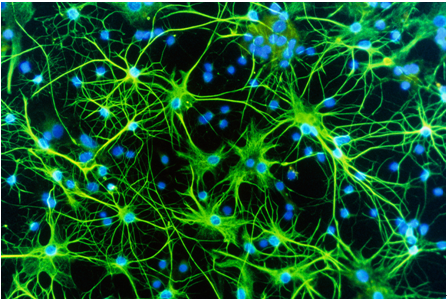 研究发现星形胶质细胞在散发性运动神经元疾病中的保护作用
