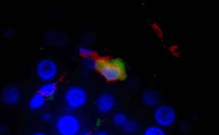 减少肝巨噬细胞可减少大鼠的炎症蛋白