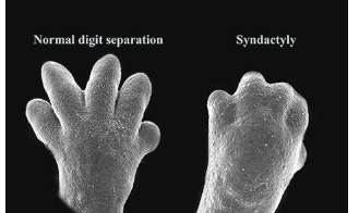 在胚胎发育过程中人的手指是从原始的垫状结构雕刻而成的