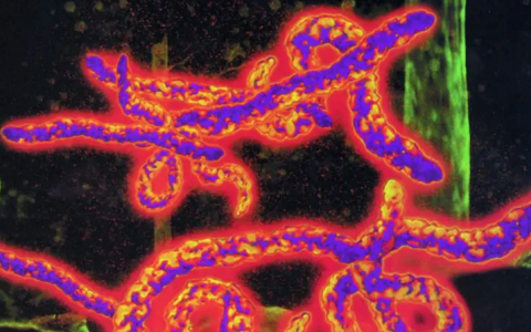 什么是埃博拉病毒潜伏期多长？埃博拉病毒(烈性传染病病毒)的症状有哪些