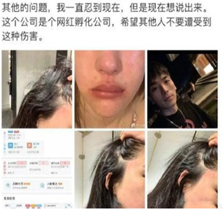 抖音潘南奎现状最新消息怎么样了？潘南奎被打事件起因经过结果始末梳理