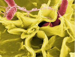 坂崎克罗诺杆菌是什么有何危害？沙门氏菌是什么原因引起的有何症状
