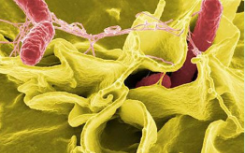 坂崎克罗诺杆菌是什么有何危害？沙门氏菌是什么原因引起的有何症状